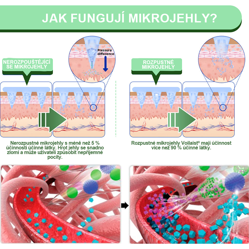 🍏Voilaist® SMGT-GLP-1 Nano Microneedlová Náplast ⏰ (Bezbolestná, dlouhotrvající, zaměřená na řešení cukrovky, obezity a kardiovaskulárních onemocnění)