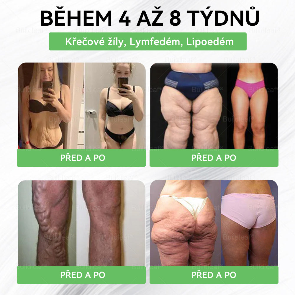🌿 Oficiální obchod ČR | BuildLeaf® GLP-1 8-v-1 Fit & Vital Řešení (Jednou denně, viditelné změny za 7 dní) ✅ Obezita, kardiovaskulární zdraví, cukrovka, spánková apnoe, zdraví střev, problémy se klouby a další.