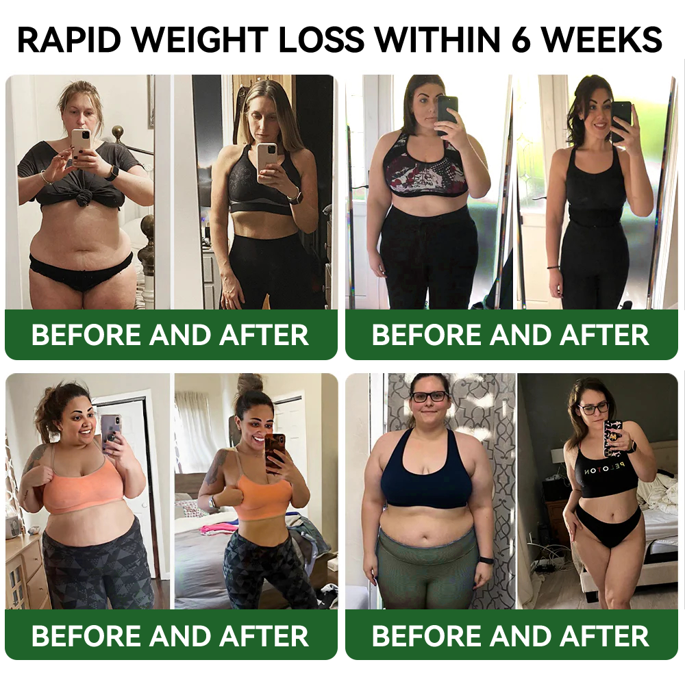 HHVB® GLP-1 Slimming & Health Boost Drops | Spalovač tuků potravinářské kvality (Vyvinuto společností The Obesity Society)