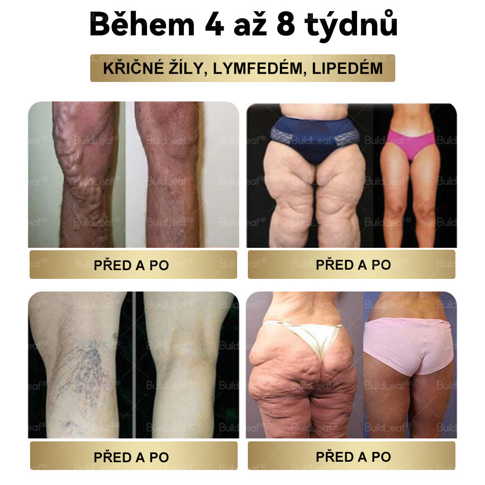 💥💥Oficiální doporučení NZZ | BuildLeaf® TIRZEPATIDE GLP-1 bylinný perorální roztok